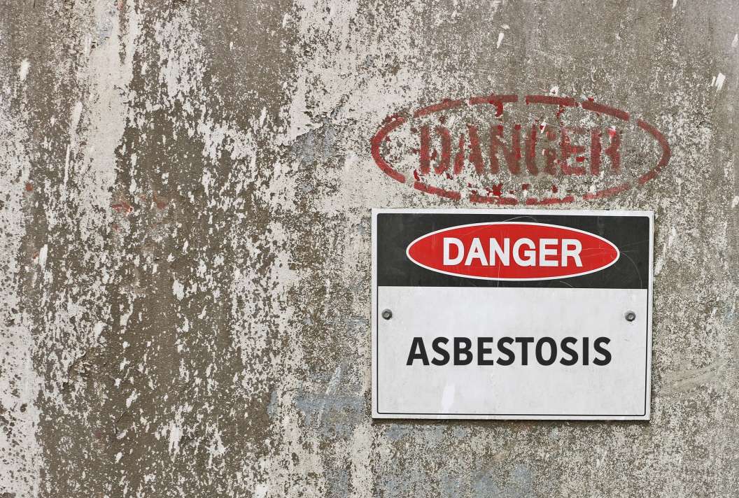 Asbestosis Compensation Claims
